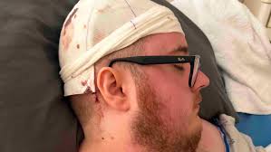 Fundraiser by Kris Madison : Kolton's cancer journey: His brain cancer has  returned