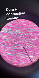 Dense Connective Tissue Tissue Elastic Wavy