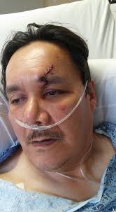 Tobias Thomsen has had a crash and is injured