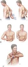 Image result for Lift-Off Subscapularis Test