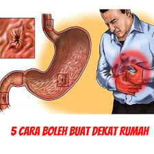 Istimewa khas buat anda semua. 5 Cara Hilangkan Gastrik Angin Yang Duomix Tips Gastrik Facebook