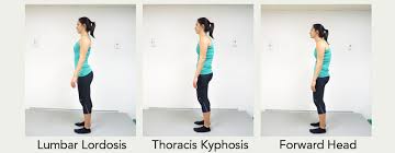 Scoliosis is a condition in which the spine cord is bent to some extent. 5 Scoliosis Exercises Children S Health Orange County