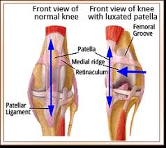 A retinaculum (plural retinacula) is a band of thickened deep fascia around tendons that holds them in place. Patellar Luxation Metropolitan Veterinary Associates