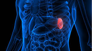 Image result for Splenomegaly