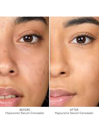 BY TERRY Hyaluronic Serum Concealer, 6. Peach Beige