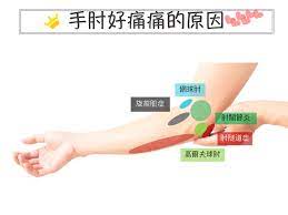 在十三、十四 世紀的法國，網球被稱為手的運動，( jeu de paume)，而現在之所以會被稱之為網球有可能是從法文的 (tenez)演變而來的，這個意思就是說：拿它或計劃 (take it or plan) 。. ç¶²çƒè‚˜æ€Žéº¼è¾¦ æ‰‹è‚˜ç—›å°±æ˜¯ç¶²çƒè‚˜å—Ž å°åŒ—åŽŸåŠ›å¾©å¥ç§'è¨ºæ‰€ ä¾¯é˜å ¡é†«å¸«