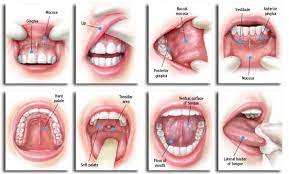 Where and how large is it? Oral Cancer Screenings Albertville Gadsden