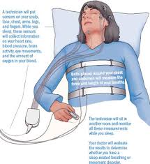 Image result for Sleep Apnea