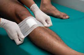 Über 7 millionen englische bücher. Open Wound Care Types Risks And Treatment