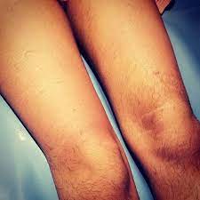 It S That Time Of Year Why Spend Time Shaving And Dealing With Stubble When You Could Remove Hair And Have Silky Smoo Wax Hair Removal Smooth Skin Waxing Legs