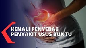 Last updated on november 21, 2017 by tongkrongan islami. Kesihatan Anda Keutamaan Kami Tanda Tanda Sakit Apendik Cute766