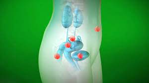 Endometriose Extreme Schmerzen Wahrend Der Periode Gesundheit Br Fernsehen Fernsehen Br De