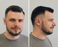 This bald haircut will look best with the trimmed mustache and beard. Hairstyles For Balding Men