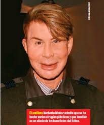 Norberto Muñoz El doble del 'Doctor Bótox'