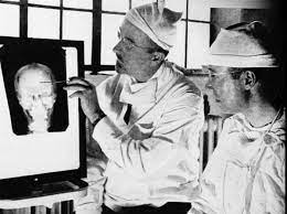 かつて精神疾患の治療法として用いられたロボトミー手術を受けた患者のビフォア・アフター写真（1940年代） (2019年2月3日) - エキサイトニュース