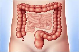 We did not find results for: Ulcerative Colitis