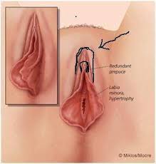 Dazu ist sie sehr dink und hart geworden, also angeschwollen. Komische Schamlippen Sex