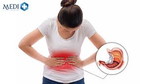 7 loại thuốc chữa đau dạ dày hiệu quả tốt hiện nay