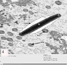 Ultrathin Section Of Unfrozen Spermatozoa Of A Control Bull Showing A Download Scientific Diagram