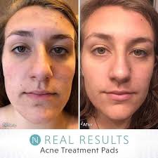 Introduction to Neora through long-term friendship