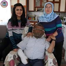 Em 2013, um homem turco chamado Ibrahim Yücel trancou sua cabeça em uma  gaiola para parar de fumar. Sua esposa possui a única chave e a utiliza  apenas para liberá-lo durante as