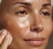 Cómo usar el vinagre de manzana para eliminar las arrugas ...