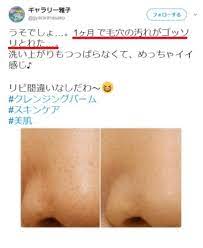 ガバガバに開ききった私の毛穴が まさかたった1ヶ月でちゅるん小鼻になれるとは を変えるだけのクソ簡単な方法がスゴかった angeria 毛穴 美容 簡単
