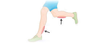 How To Get Rid Of Stiff Legs Calf Pain And Shin Splints After Running