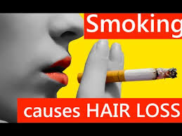 The association was largely attributed to toxins in smoke one question is whether the link is a result of tobacco toxins directly affecting the scalp, or of smoking's causing severe disease that speeds aging. How To Regrow Your Hair Naturally Smoking Causes Hair Loss Youtube