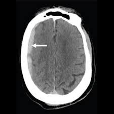 Image result for CT Head