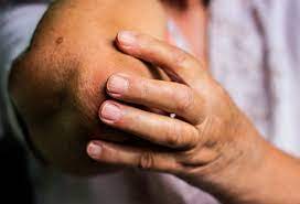 When a bone tumor grows, it presses on healthy bone tissue and can destroy it, which causes the following symptoms: Visual Guide To Bone Cancer