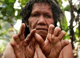Check spelling or type a new query. Potong Jari Tradisi Berbela Sungkawa Di Papua