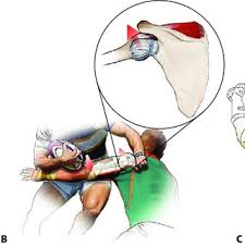 Image result for Fall on Shoulder