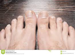 10 pies con las uñas más largas; Unas Del Pie Largas Foto De Archivo Imagen De Atractivo 99374138