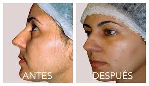 Luz Pulsada Como Eliminar La Barba Para Siempre Hombres Barba Como Quitarme  Los Vellos De La