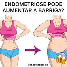 Some symptoms include pelvic pain, heavy periods. Pin Em Endometriose