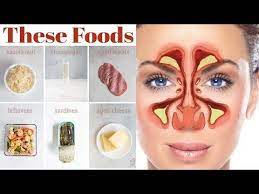 High Histamine Foods Top Six To Avoid Seasonal Allergies Sinusitis Sinus Problems