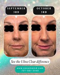 Beautiful memory of my sweet Jacob and adorable Bella pup ❤️‍🩹 Love you Jacob  Knudsen!