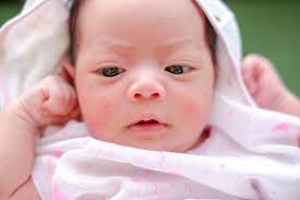 Cewek cantik memamerkan tubuh indahnya. Jerawat Pada Bayi Apa Penyebab Dan Bagaimana Cara Mengatasinya