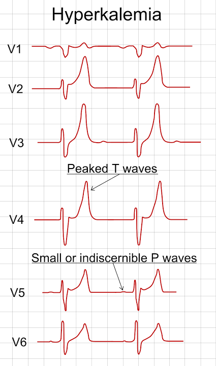 Image result for ecg"