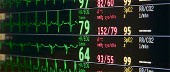 Elle est responsable d'un décès toutes les 7 minutes en france. La Frequence Cardiaque Quel Interet A Connaitre Sa Frequence Cardiaque Maximale Fiches Sante Et Conseils Medicaux