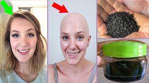 ضعيه على جلدة الرأس مكان الصلع ينبث الشعر سبحان لله بسرعة فائقة شعر كثيف في 7 أيام Youtube Beauty Recipes Hair Hair Care Oils Beauty Skin Care Routine