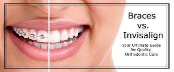 See full list on drarocha.com Invisalign Vs Braces Which Is Right For You Ultimate Guide