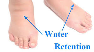 Discover 10 common ways to reduce water retention at 10faq health and stay better informed to make healthy living decisions. Ways To Reduce Water Retention Dietsolutionsparul
