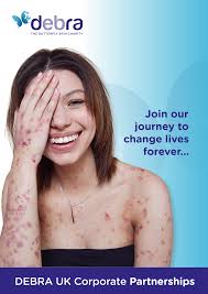 DEBRA UK Corporate Partnerships