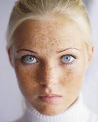 Blonde Hair Blue Eyes And Freckles Mmmmm Beautiful Freckles Freckles Freckle Face