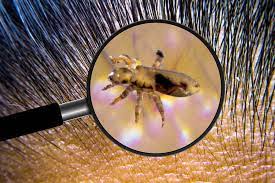 Does Bleach Kill Lice Pestguide Org
