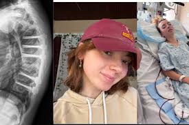 Fundraiser for Madison McCullough by Mikayla and Mackenzie : Support  Madison McCullough's Recovery After Spine Surgery