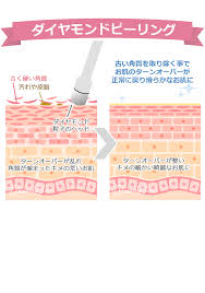 ダイヤモンドピーリング あらゆる悩みに効く ダウンタイムのないピーリング 美肌エステと美肌脱毛のオーシャンブルー ニキビ跡 脱毛 ニキビ