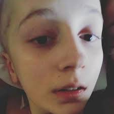 Fundraiser for Kate Pace by Elizabeth Komarnicki : Natalie's Osteosarcoma  Battle